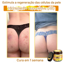 (Compre 1 Leve 2)🔥 LOVILDS™ Creme Multifuncional com Veneno de Abelha 👩⚕️Aprovado por Dermatologistas ✅