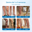 (Compre 1 Leve 2) Spray de ervas Timilk® VeinGuard - ✅ Clinicamente comprovado que elimina varizes em apenas 7 dias!