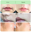 Kit de Creme Depilatório para Mulheres