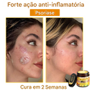 (Compre 1 Leve 2)🔥 LOVILDS™ Creme Multifuncional com Veneno de Abelha 👩⚕️Aprovado por Dermatologistas ✅