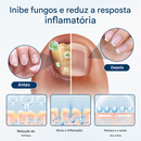 (Compre 1 Leve 2)🔥 Spray de ervas para reparação de fungos Timilk® OnyxiGuard