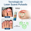 (Compre 1 Leve 2)🔥 Spray de ervas para reparação de fungos Timilk® OnyxiGuard