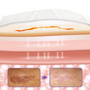 (Compre 1 Leve 2) Fita de pele com microagulhas Timilk® HyaRepair