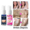 Novo spray depilatório semipermanente Conservatiy®