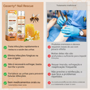 Ceoerty® Resgate das Unhas Spray de Veneno de Abelha