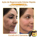 (Compre 1 Leve 2)🔥 LOVILDS™ Creme Multifuncional com Veneno de Abelha 👩⚕️Aprovado por Dermatologistas ✅