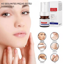 🔥Creme facial clareador de sardas com vitamina C, remove melasma, manchas escuras e clareia a melanina