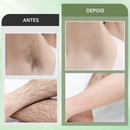 Kit de Creme Depilatório para Mulheres