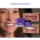 Pó Mineral de Restauração Dental 🦷