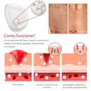 Adesivo Derma Smooth para Remoção de Sinais e Verrugas ✨
