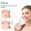 (Compre 1 LEVE 2)🔥 Caneta a Laser LOVILDS™ para Remoção de Sinais e Verrugas Sem Cirurgia ✅
