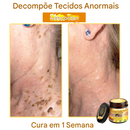 (Compre 1 Leve 2)🔥 LOVILDS™ Creme Multifuncional com Veneno de Abelha 👩⚕️Aprovado por Dermatologistas ✅