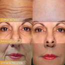 🔥Creme facial firmador polipeptídico - MUDE PARA UMA PELE BONITA EM 1 SEMANAS