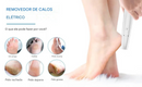Removedor de calos elétrico para pés