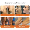 (COMPRE 1 LEVE 2)🔥 Creme Completo ODALIT™ com Veneno de Abelha