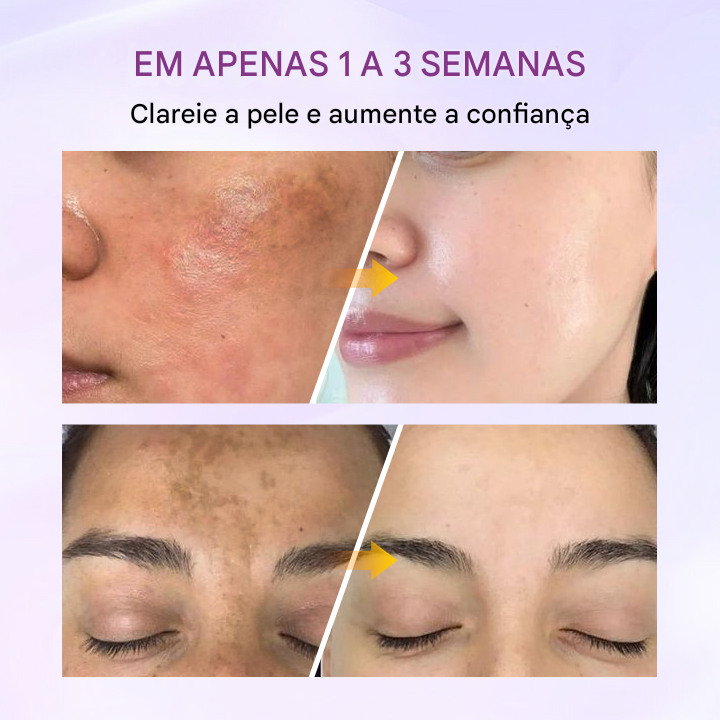 Biancat® RadiantClear Sérum Iluminador e Antimanchas