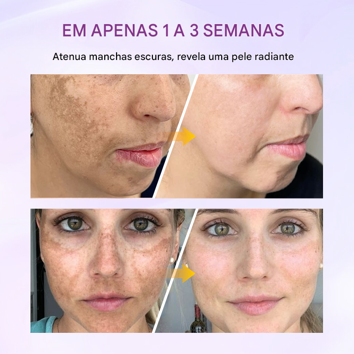 Biancat® RadiantClear Sérum Iluminador e Antimanchas