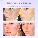 Biancat® RadiantClear Sérum Iluminador e Antimanchas