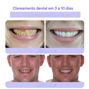 Pó Mineral de Restauração Dental 🦷