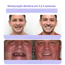 Pó Mineral de Restauração Dental 🦷