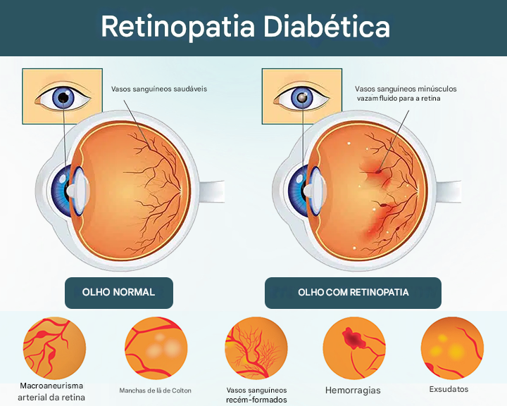 Timilk® OptiFusion Nano Eye Drops Serum — Tecnologia Nano que Restaura a Visão Clara, Sem Óculos, Sem Cirurgia