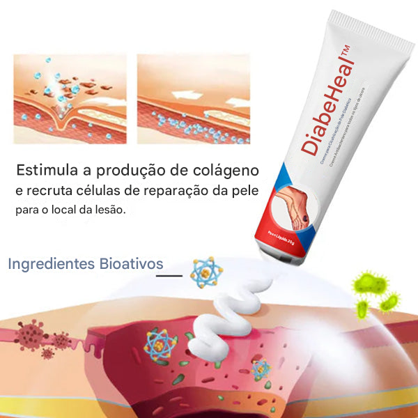DiabeHeal™ Creme de Cicatrização da Pele para Diabéticos