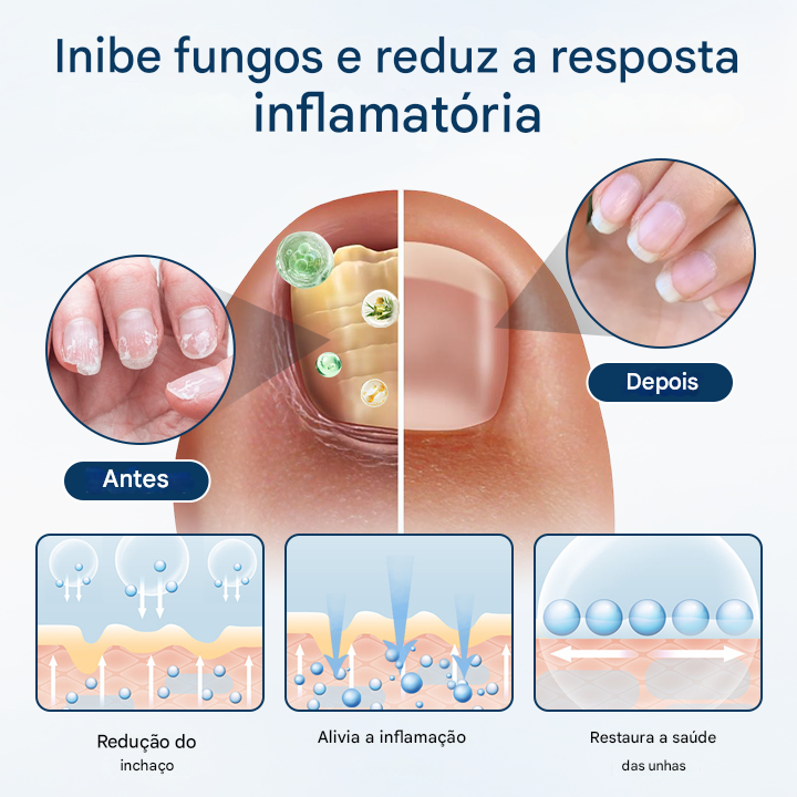 (Compre 1 Leve 2)🔥 Spray de ervas para reparação de fungos Timilk® OnyxiGuard