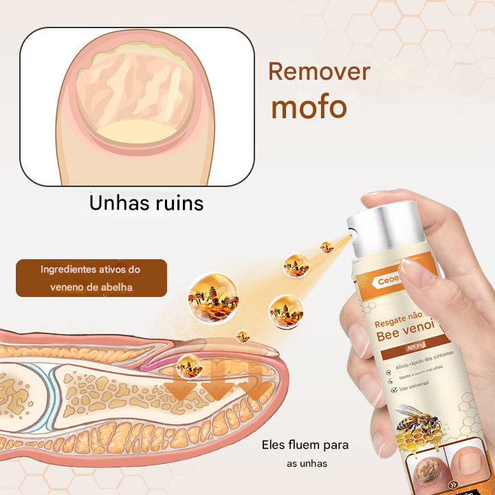 Ceoerty® Resgate das Unhas Spray de Veneno de Abelha