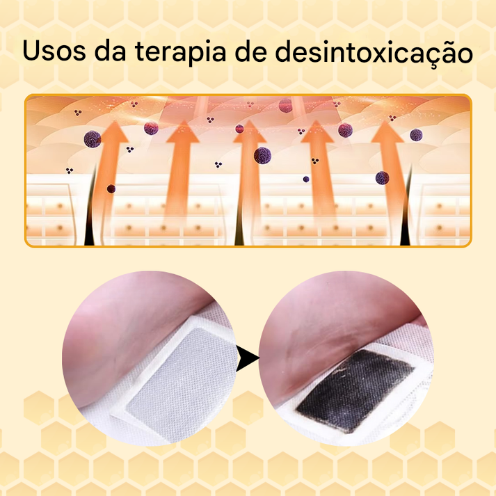 Adesivos para tratamento de articulações com veneno de abelha