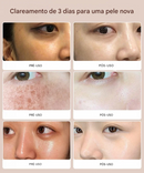 Sabonete Facial Purificante e Clareador com Niacinamida