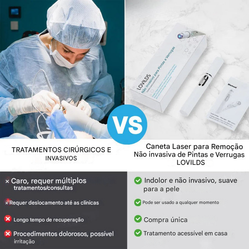 (Compre 1 LEVE 2)🔥 Caneta a Laser LOVILDS™ para Remoção de Sinais e Verrugas Sem Cirurgia ✅