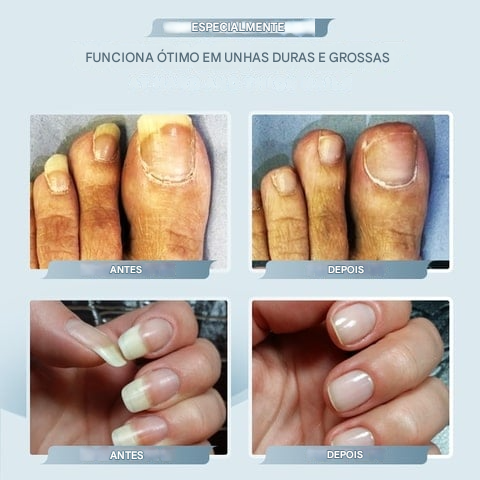 🔥Cortador de unhas de aço inoxidável ultra afiado