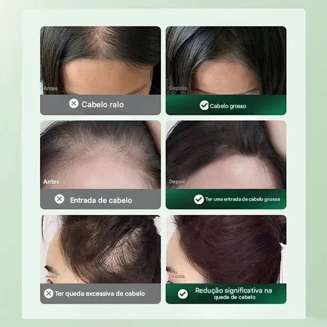 SOLUÇÃO ANTI-QUEDA DE CABELO E CRESCIMENTO CAPILAR
