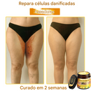 (Compre 1 Leve 2)🔥 LOVILDS™ Creme Multifuncional com Veneno de Abelha 👩‍⚕️Aprovado por Dermatologistas ✅