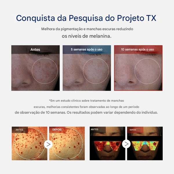🧪 TX Cream – para Manchas Escuras e Hiperpigmentação ✨