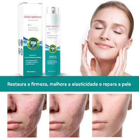 Spray Avançado para Cicatrizes – Para Todos os Tipos de Cicatrizes