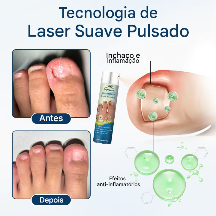 (Compre 1 Leve 2)🔥 Spray de ervas para reparação de fungos Timilk® OnyxiGuard