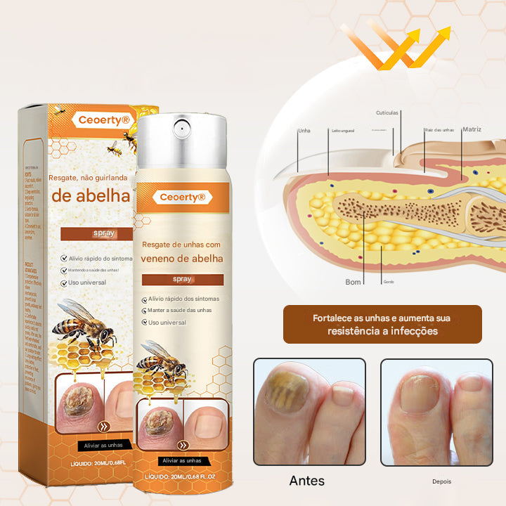 Ceoerty® Resgate das Unhas Spray de Veneno de Abelha