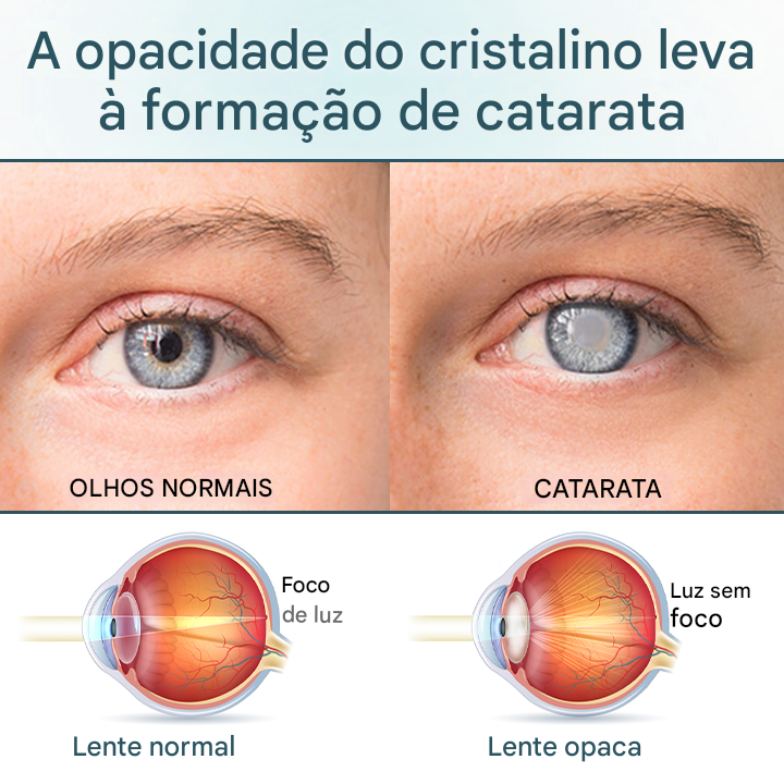 Timilk® OptiFusion Nano Eye Drops Serum — Tecnologia Nano que Restaura a Visão Clara, Sem Óculos, Sem Cirurgia