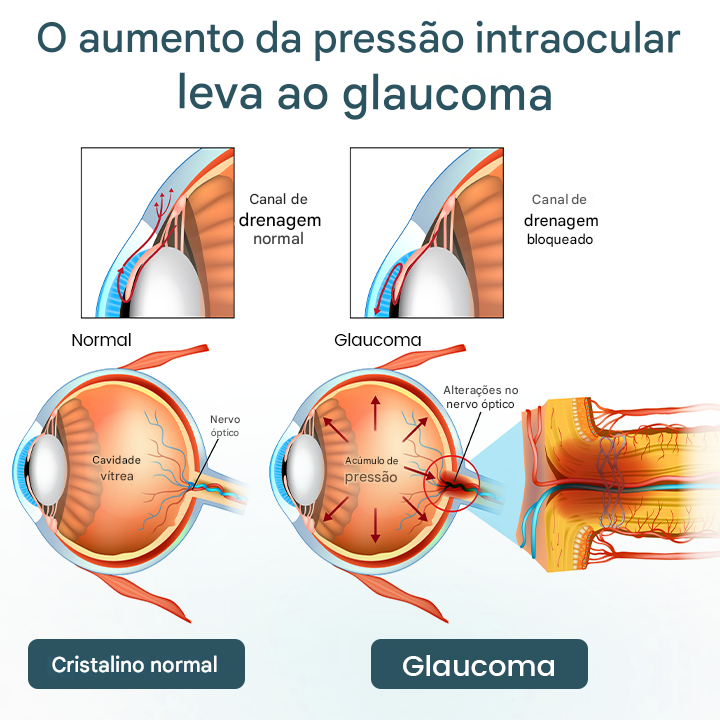 Timilk® OptiFusion Nano Eye Drops Serum — Tecnologia Nano que Restaura a Visão Clara, Sem Óculos, Sem Cirurgia