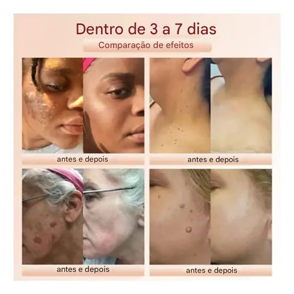 ⚡ Venda Flash ⚡ QUARXERY Esfoliante em Gel Suave ✨