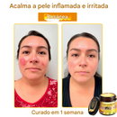 (Compre 1 Leve 2)🔥 LOVILDS™ Creme Multifuncional com Veneno de Abelha 👩‍⚕️Aprovado por Dermatologistas ✅