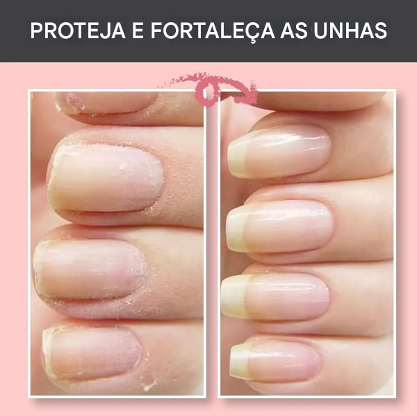 🔥Gel de Proteção e Reparação das Unhas