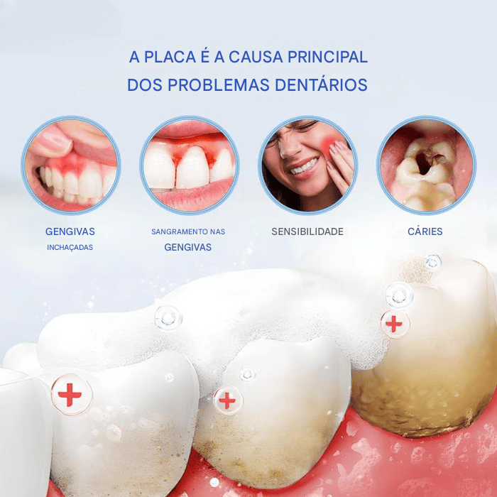 (Compre 1 Leve 2) ✨🦷 Creme dental clareador com niacinamida - Para dentes mais brancos e saudáveis!