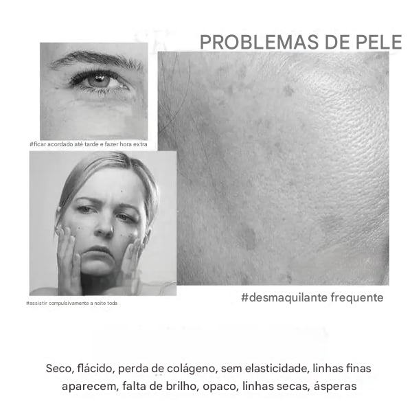 🔥Creme facial firmador polipeptídico - MUDE PARA UMA PELE BONITA EM 1 SEMANAS