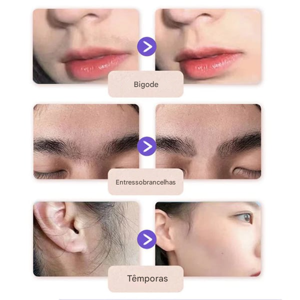 🔥 Creme Suave e Indolor para Remoção de Pelos Faciais