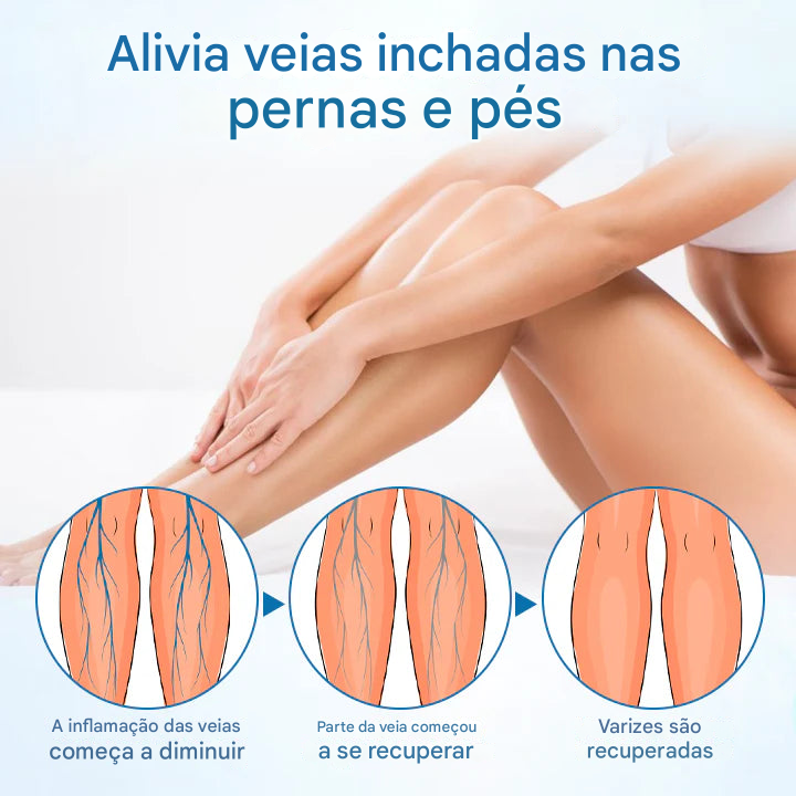 (Compre 1 Leve 2) Spray de ervas Timilk® VeinGuard - ✅ Clinicamente comprovado que elimina varizes em apenas 7 dias!