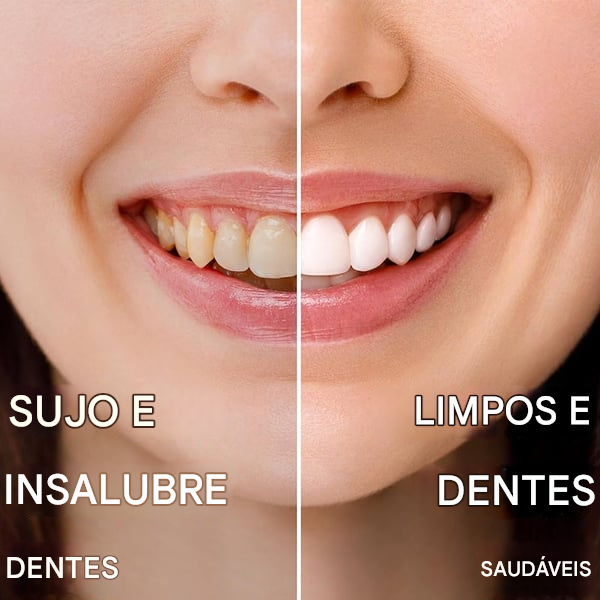 🥳Creme Dental de Hidroxiapatita