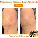 (Compre 1 Leve 2)🔥 LOVILDS™ Creme Multifuncional com Veneno de Abelha 👩‍⚕️Aprovado por Dermatologistas ✅