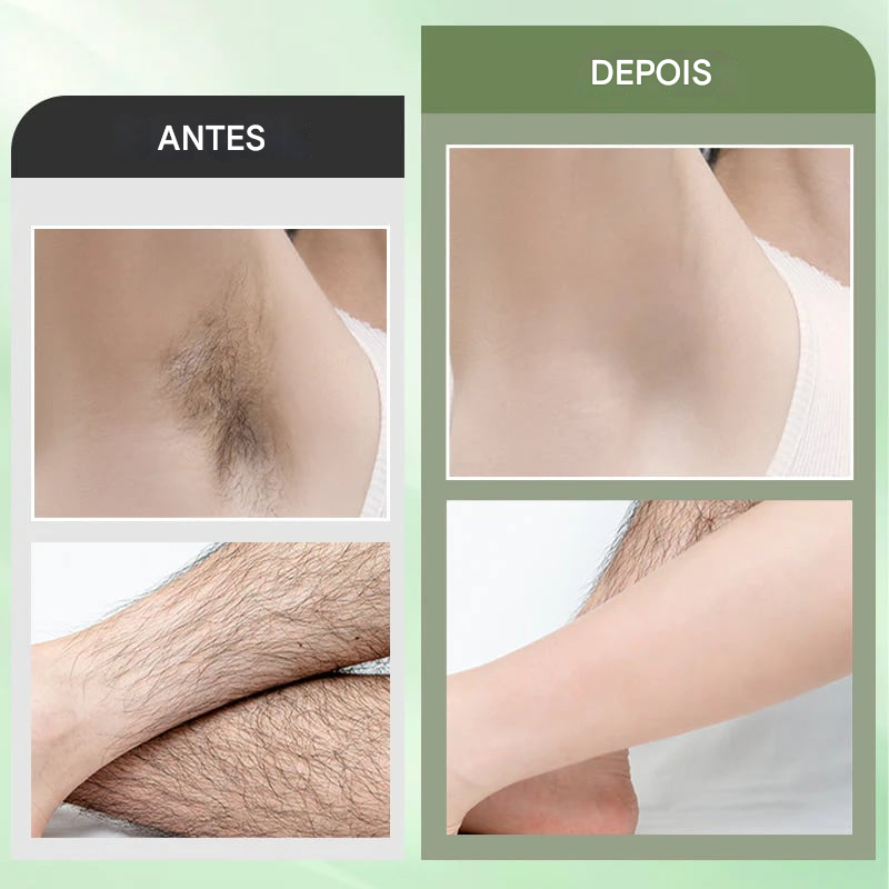 Kit de Creme Depilatório para Mulheres